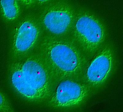 Poland: EIB to support Ryvu Therapeutics&rsquo; discovery, research and development of new cancer treatments with &euro;22 million